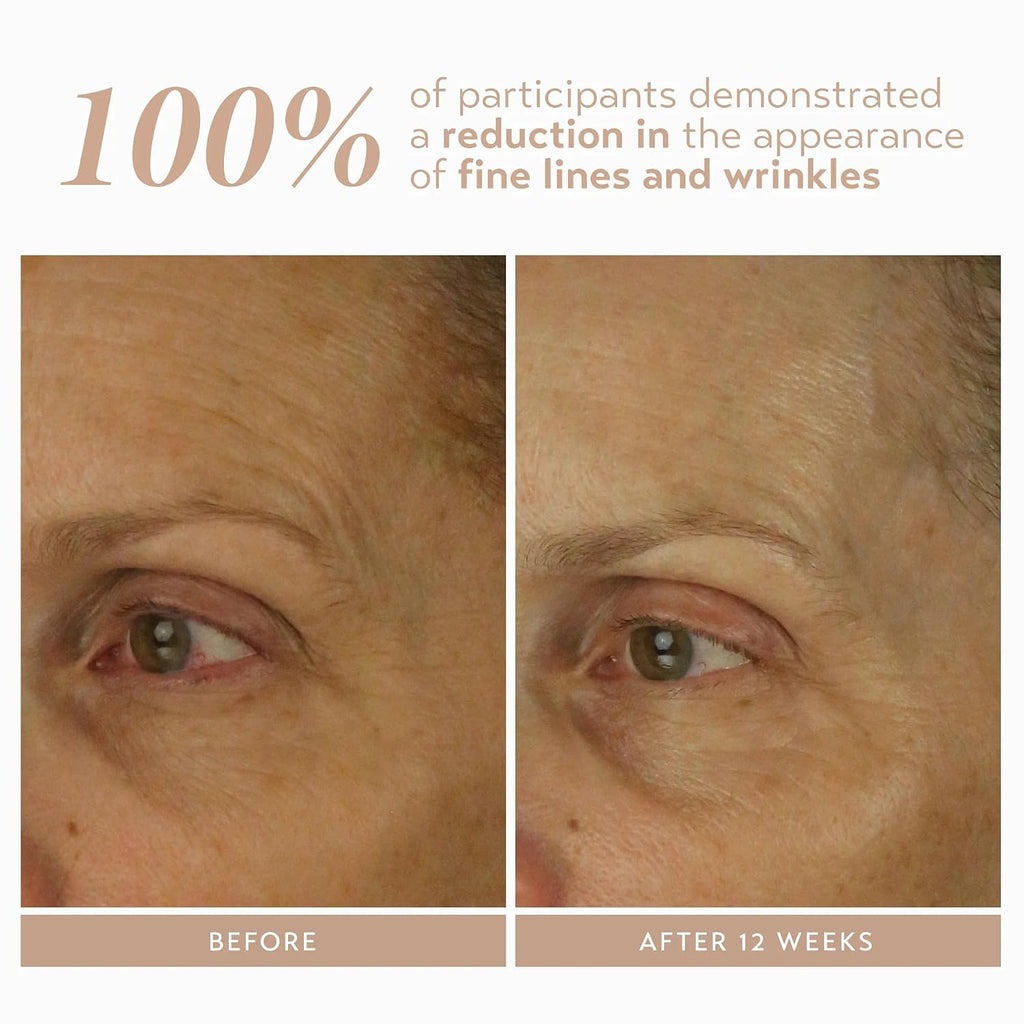 Skincare Retinol Reform with 1% Encapsulated Retinol Serum