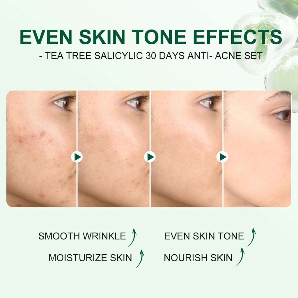 Tea Tree Salicylic Acid Facial Skin Care Set, Acne Treatment Skincare Set ,Skincare Mini Kit, Facial Kit Gifts for Women,Cleanser, Toner, Serum, Cream,Oil Control Facial Kit, Travel Size Set
