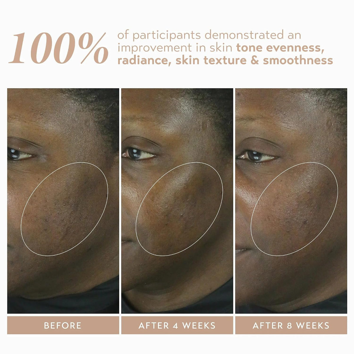 Skincare Retinol Reform with 1% Encapsulated Retinol Serum