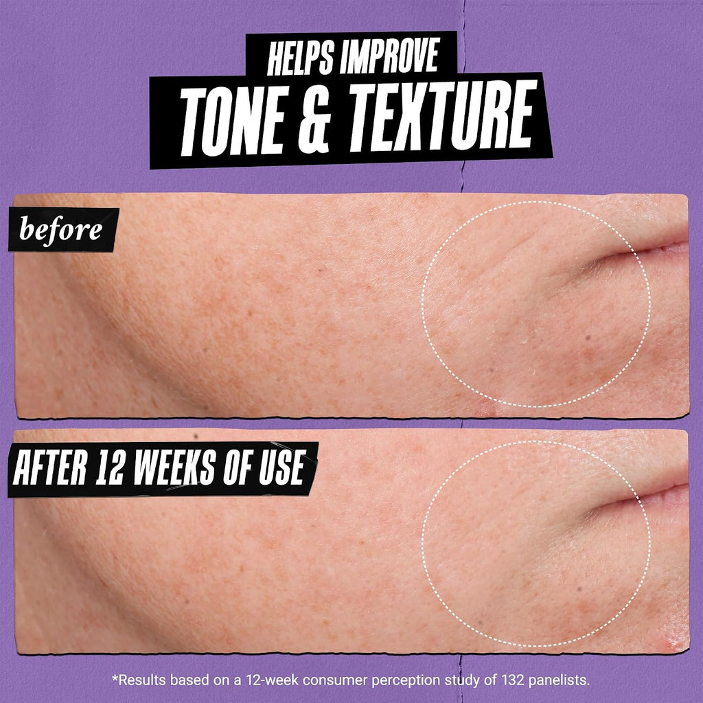 Kiehl'S - Retinol Skin-Renewing Daily Micro-Dose Serum, Reduces Wrinkles
