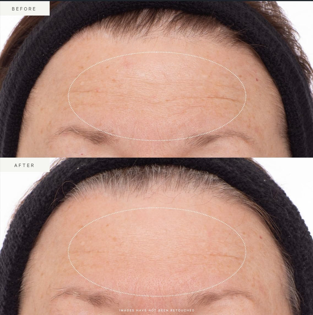 Plant Stem Cell Retinol Alternative Serum, Firming Face Serum