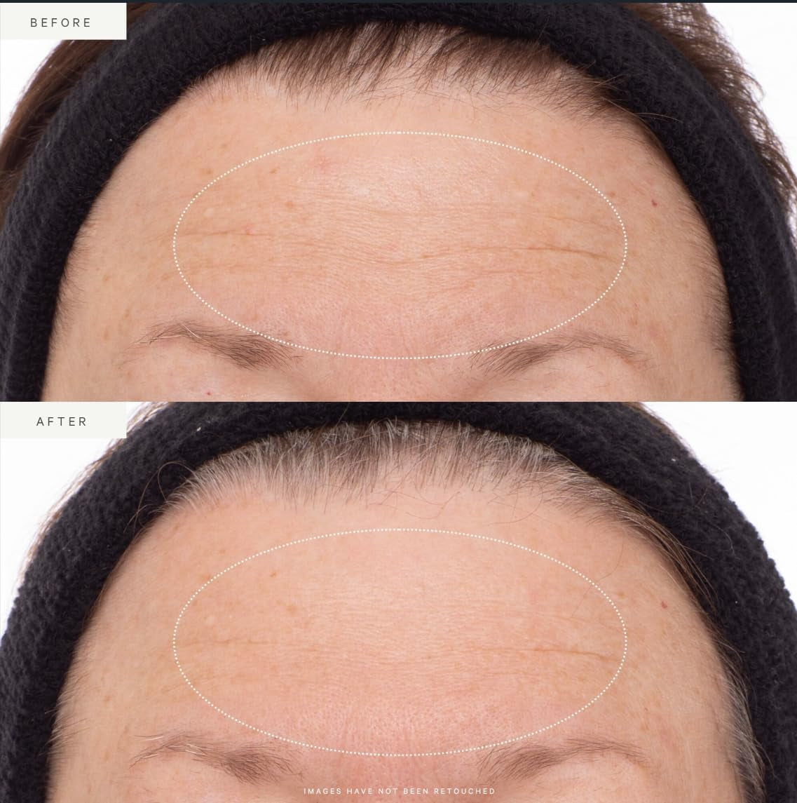 Plant Stem Cell Retinol Alternative Serum, Firming Face Serum