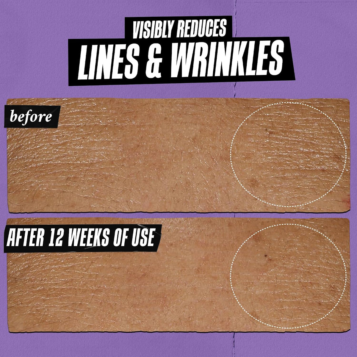 Kiehl'S - Retinol Skin-Renewing Daily Micro-Dose Serum, Reduces Wrinkles