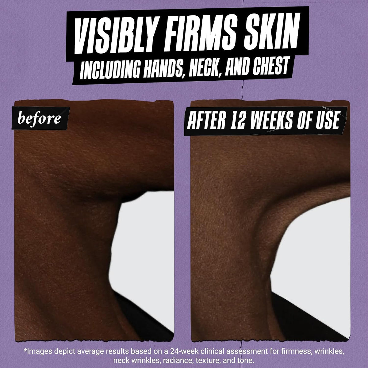 Kiehl'S - Retinol Skin-Renewing Daily Micro-Dose Serum, Reduces Wrinkles